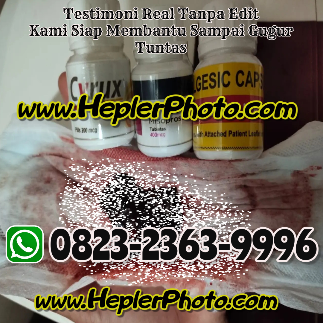 Cara Menggugurkan Kandungan Secara Alami, Tindakan Medis, Obat Aborsi